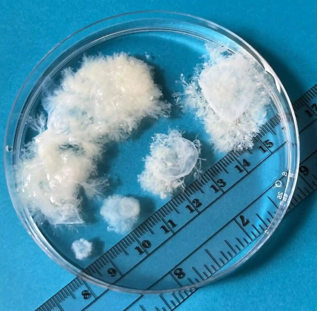 White tissue in a petri dish. It shows five blobs, each a bit larger than the previous one. A centimetre measure lies under the bowl to clarify the scale. The smallest blob has a diameter of about half a centimetre. The largest is almost eight centimetres long.
